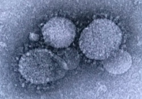 Cifra de infectados por Covid-19 podría ser mayor